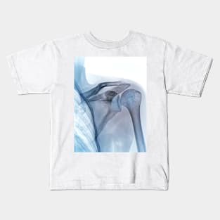 Shoulder joint, X-ray (C040/3239) Kids T-Shirt